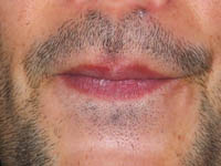 ���t���̌`